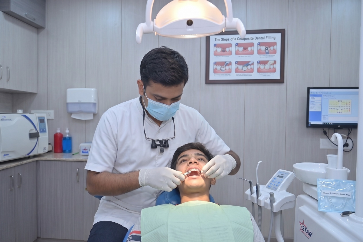 Aligner Treatment