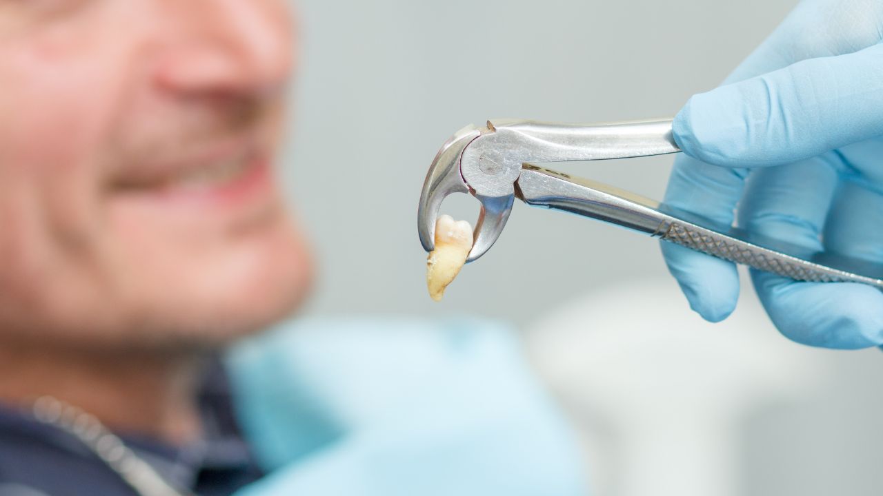 Painless Extraction