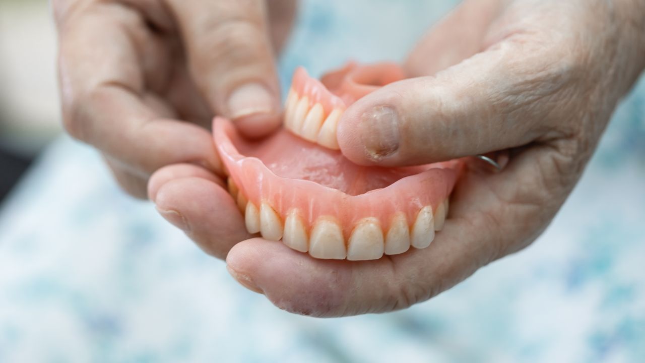 Removable Partial Denture